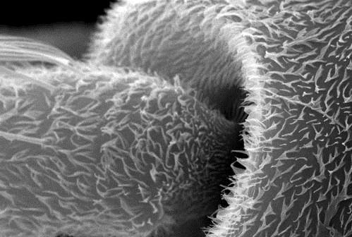 显微镜下的奇妙世界：从鱿鱼吸盘到血吸虫(图)
